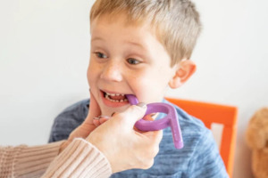 Oral Placement Therapy